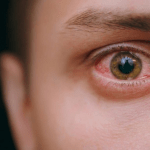 ¿Pérdida de la visión por el COVID? Estudio detecta coágulos en los ojos como secuela